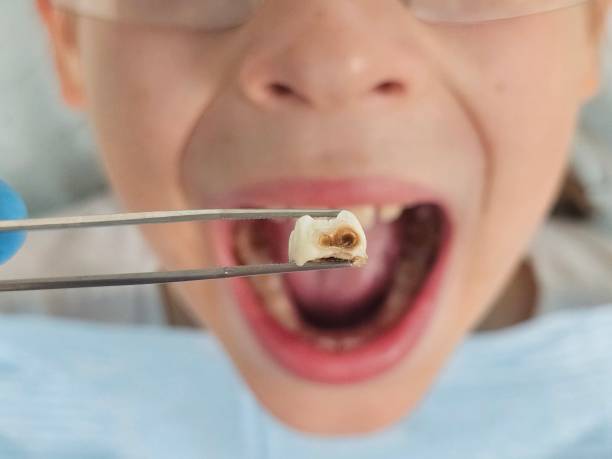 Best Weekend Emergency Dentist in Nashotah, WI